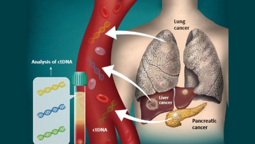 FDA Approves Blood Tests That Can Help Guide Cancer Treatment